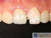 치료전후이미지