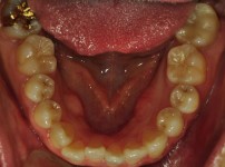 치료전후이미지