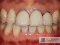 치료전후이미지