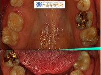 치료전후이미지