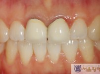 치료전후이미지