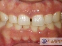 치료전후이미지