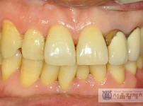 치료전후이미지