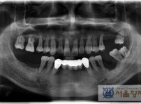 치료전후이미지