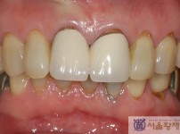 치료전후이미지