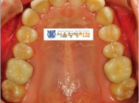 치료전후이미지