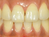 치료전후이미지