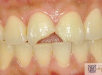 치료전후이미지