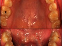 치료전후이미지