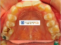 치료전후이미지