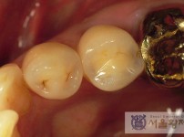 치료전후이미지