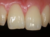 치료전후이미지