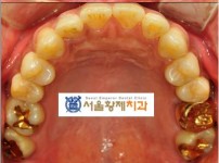 치료전후이미지