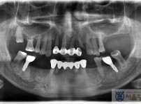 치료전후이미지