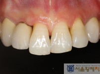 치료전후이미지