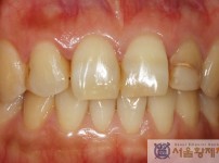 치료전후이미지