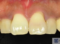 치료전후이미지