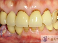 치료전후이미지