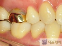 치료전후이미지