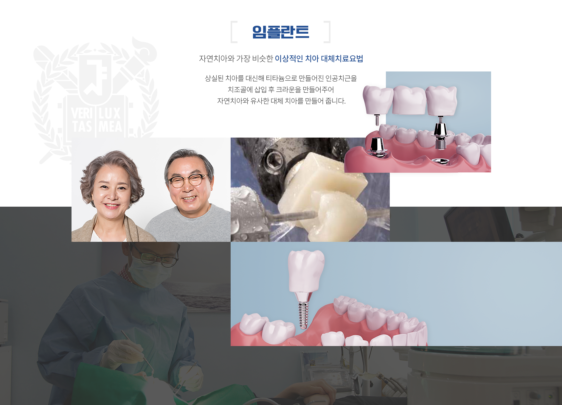 임플란트-자연치아와-가장-비슷한-이상적인-치아-대체치료요법