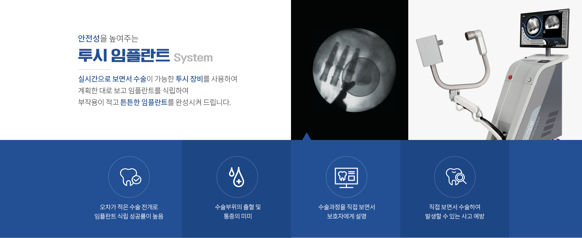 안정성을-높여주는-투시-임플란트