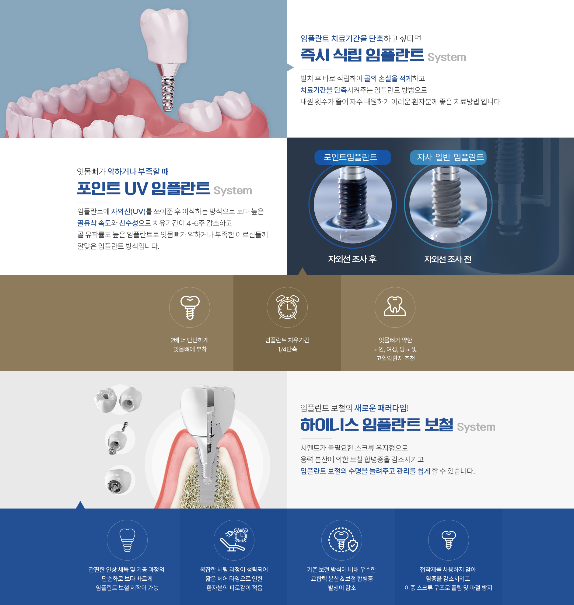  임플란트-치료기간을-단축하고-싶다면-즉시-식립-임플란트 잇몸뼈가-약하거나-부족할때-포인트-UV-임플란트 임플란트-보철의-새로운-패러다임-하이니스-임플란트-보철