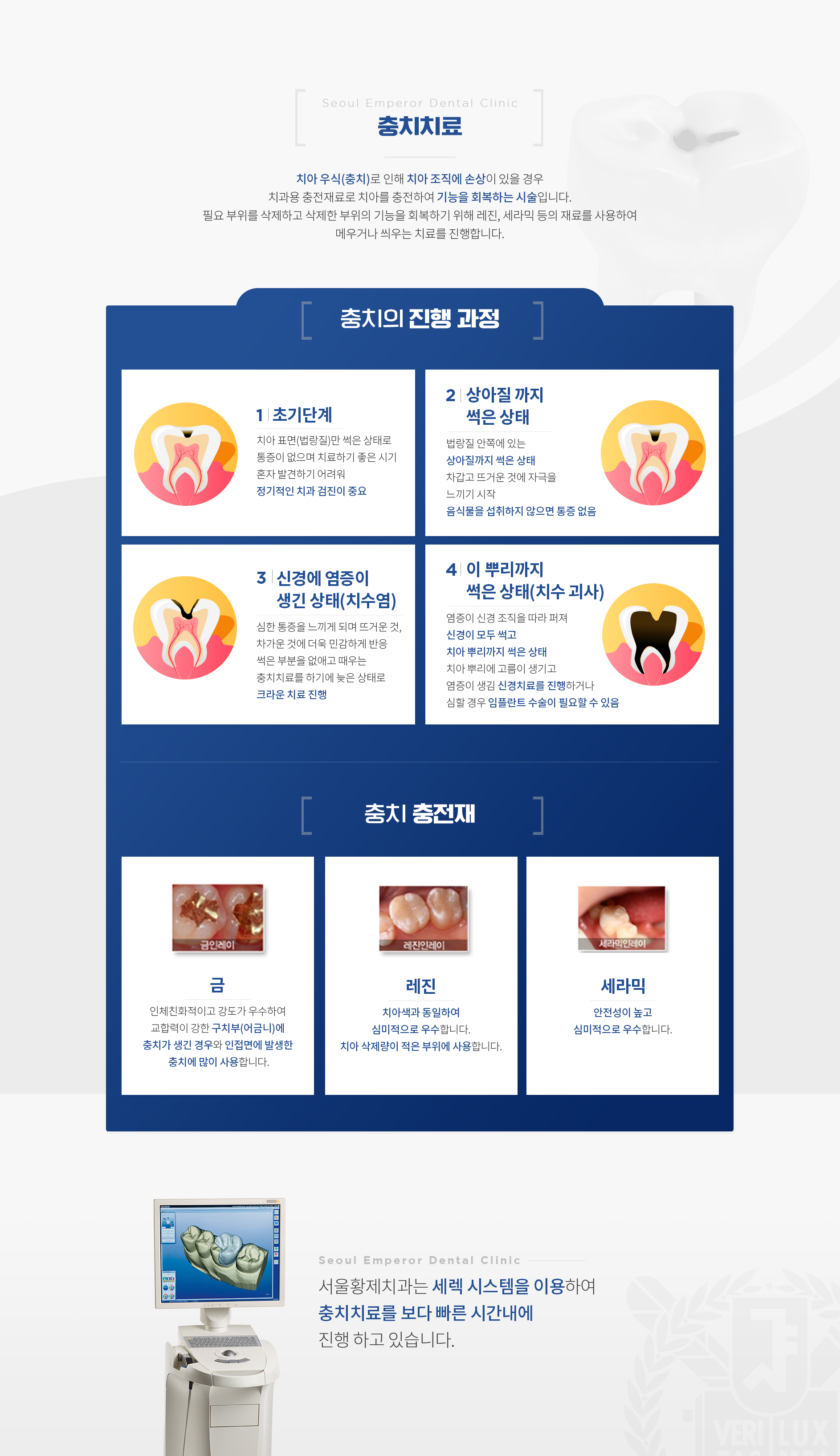 충치치료 치아-우식으로-인해-치아-조직에-손상이-있을-경우-치과용-충전재료로-치아를-충전하여-기능을-회복하는-시술입니다. 서울황제치과는-세렉-시스템을-이용하여-충치치료를-보다-빠른-시간내에-진행-하고-있습니다.